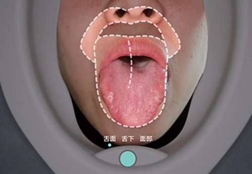 舌面象仪‍能得到普及的原因是什么？