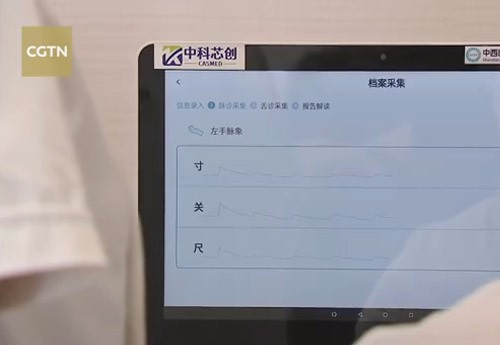 “数字中医”：#原来机器也能望闻问切#