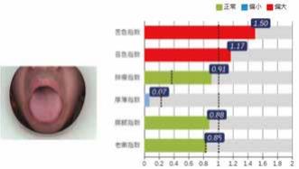 积分球光源中医舌诊仪 积分球光源中医舌诊仪